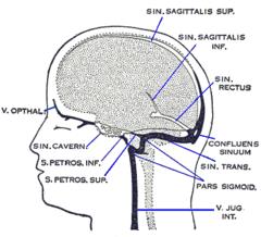 Рисунок 1. Анатомия синусов головного мозга