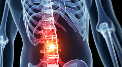 Влияние сроков хирургической декомпрессии при острой травме спинного мозга: обобщенный анализ индивидуальных данных пациентов.