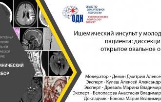 Ишемический инсульт у молодого пациента: диссекция vs открытое овальное окно