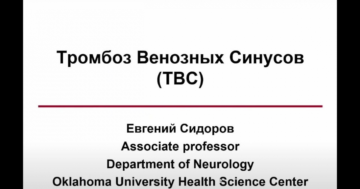 Видео лекции по неврологии. Церебральный венозный тромбоз. Риногенный синустромбоз. Тромбоз венозного синуса на кт. Тромбоз венозного синуса головного мозга мкб