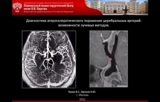ДИАГНОСТИКА АТЕРОСКЛЕРОТИЧЕСКОГО ПОРАЖЕНИЯ ЦЕРЕБРАЛЬНЫХ АРТЕРИЙ
