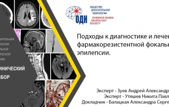 Подходы к диагностике и лечению фармакорезистентной фокальной эпилепсии