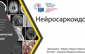 Нейросаркоидоз